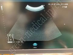 Hitachi Diagnostic Ultrasound Scanner