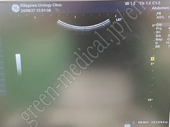 GE Healthcare Ultrasound Color Doppler