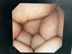 SONY Medical Grade LCD Monitor