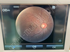 TOPCON Fundus Camera