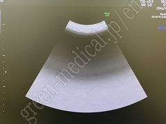 GE Healthcare Diagnostic Ultrasound System