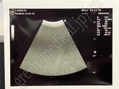 GE Healthcare Convex Probe Transducer