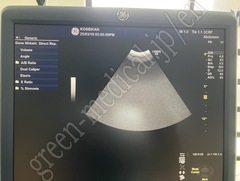 GE Healthcare Ultrasound Color Doppler