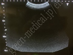 TOSHIBA Ultrasound Color Doppler