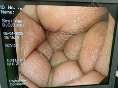 OLYMPUS High Definition Monitor