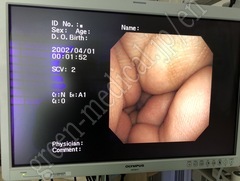 OLYMPUS Video Bronchoscope