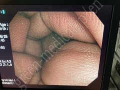 OLYMPUS High Definition Monitor