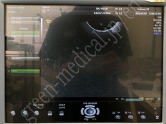 GE Healthcare Ultrasound Color Doppler