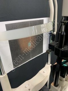 TOPCON Slit lamp