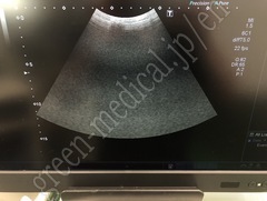 TOSHIBA Ultrasound Color Doppler