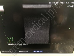 Hitachi Ultrasound Color Doppler