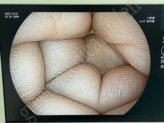 FUJIFILM Processor & Laser Lightsource