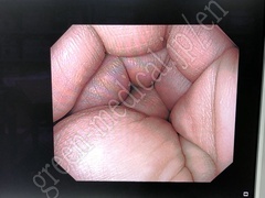 OLYMPUS High Definition LCD monitor