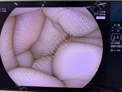 FUJIFILM Processor & Laser Lightsource