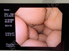 OLYMPUS Processor & Light Source