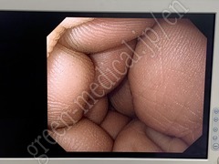 OLYMPUS Processor & Xenon Lightsource