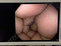 OLYMPUS Processor & Xenon Lightsource