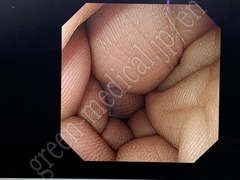 OLYMPUS Processor & Xenon Lightsource