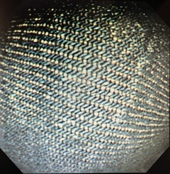 OLYMPUS Video Colonoscope