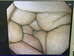 OLYMPUS Video System Center