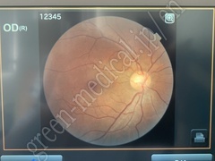 TOPCON Fundus Camera