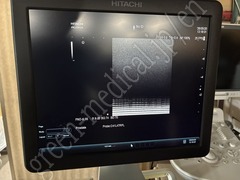 Hitachi Ultrasound Diagnostic System