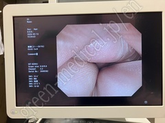 OLYMPUS Video Gastroscope