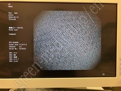 OLYMPUS Video Colonoscope