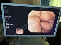 OLYMPUS Video Gastroscope
