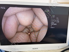 FUJIFILM Transnasal Gastroscope