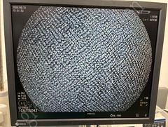 FUJIFILM Video Colonoscope