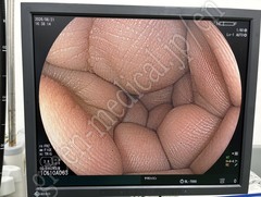FUJIFILM Video Colonoscope