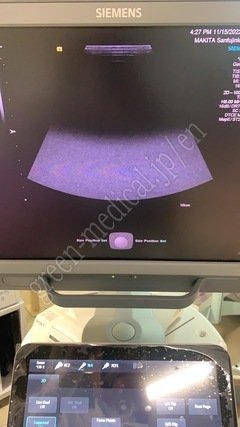 SIEMENS Color Doppler Ultrasound