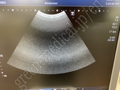 TOSHIBA Ultrasound Color Doppler