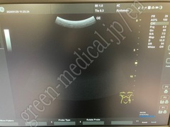 GE Healthcare Diagnostic Ultrasound Scanner