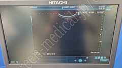 Hitachi Diagnostic Ultrasound Scanner