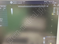 GE Healthcare Ultrasound Color Doppler