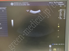 GE Healthcare Ultrasound Color Doppler