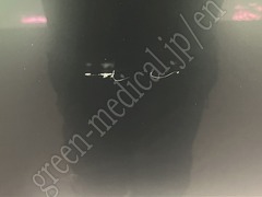 SONY Medical Grade LCD Monitor