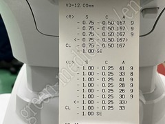 NIDEK Autorefractor Keratometer