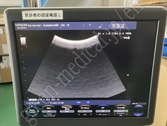 Hitachi Color Doppler Ultrasound System