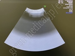 GE Healthcare Diagnostic Ultrasound System