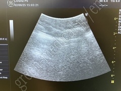 GE Healthcare Convex Probe Transducer