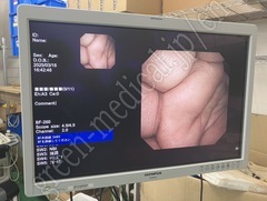 OLYMPUS Video Bronchoscope