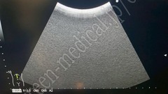 Hitachi Ultrasound Color Doppler