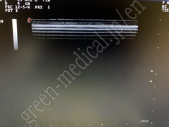 Hitachi Portable Ultrasound Color Doppler