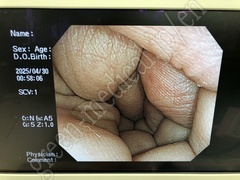 OLYMPUS Processor & Light Source