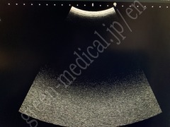 FUJIFILM Portable Ultrasound