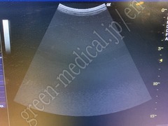 GE Healthcare Ultrasound (B/W)