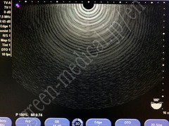 SIEMENS Ultrasound